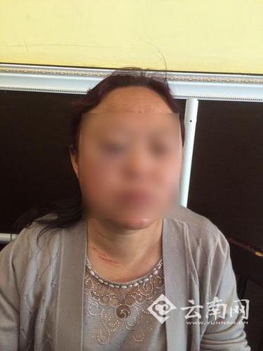 昆明一小区因停车堵消防通道连打两架 女司机称遭到6人围殴