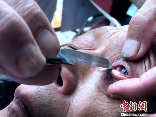 惊险又刺激的“刀锋洗眼”。　吕杨 摄
