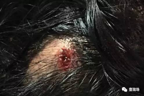 女子投诉快递员遭强行入室毒打 快递公司久不回应