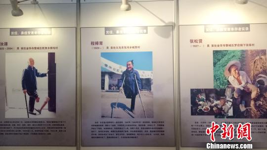 日军在浙细菌战受害幸存者的照片、悲惨遭遇口述 张煜欢 摄