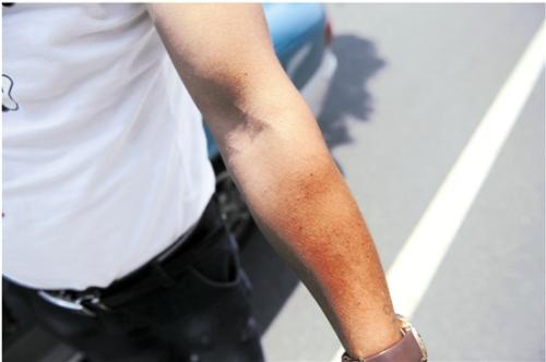 胳膊上的阴阳面取决于太阳的照射角度。