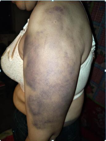 河北女子惨遭家暴20年 遭囚禁被迫给情妇洗衣做饭