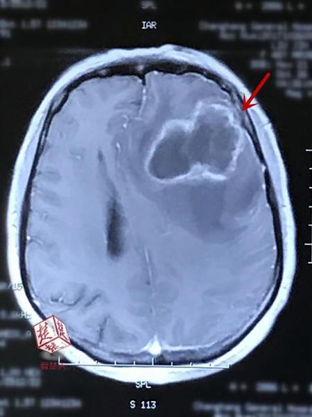 本文图片均来自楚天都市报