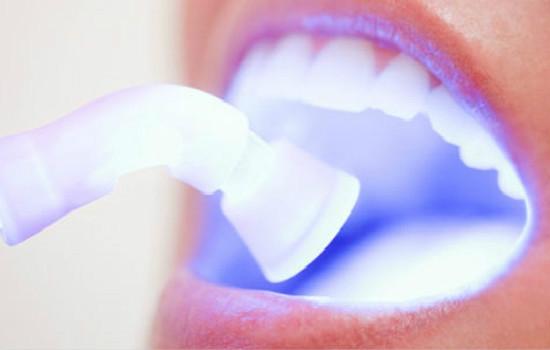 牙齿冷光美白安全吗？看看专家咋说