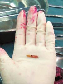 这个新年，来自双阳的李先生一家在胆战心惊中度过……