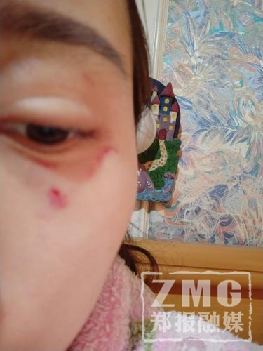 郑州女子网购投诉后 遭卖家千里奔袭设局殴打