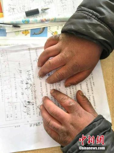 点击进入下一页