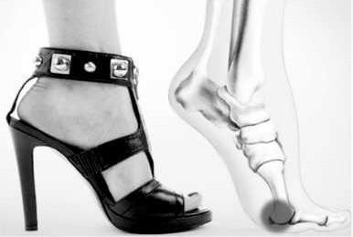 选鞋有讲究 长期穿高跟鞋易引发脚部病