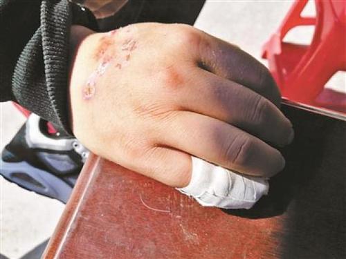 中缅边境赌场绑架案:以招工为名骗至缅甸索赎金