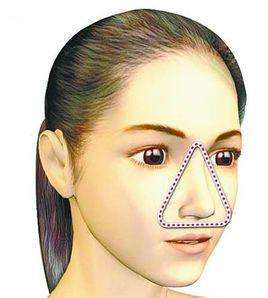 痘痘不能妄动 小心留下“美丽的遗憾”