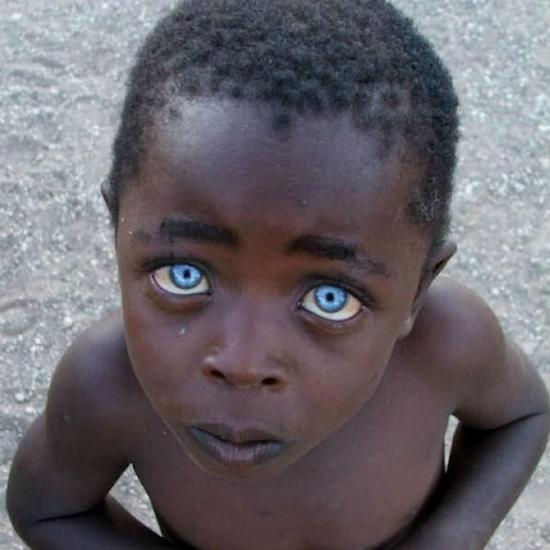 人体基因突变 你见过这样的奇人吗？