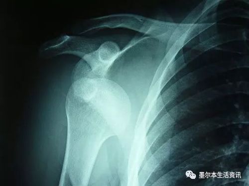 小伙和父亲正在庭院喝茶 突然一条鲨鱼从天而降