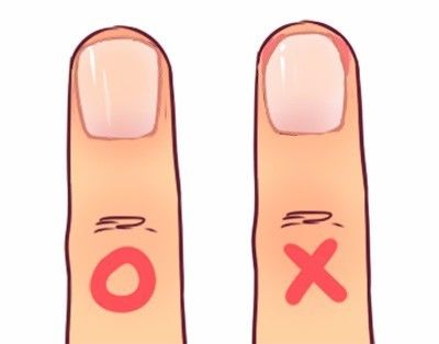 4、注意手指的保养。平时多涂点护手霜，可增加甲沟周围皮肤的抗病能力；