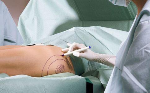 腿部吸脂分几个部位 腿部吸脂的方法有哪些 腿部吸脂有哪些优势