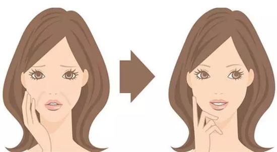 法令纹能去除吗？去除法令纹的方法有哪些？