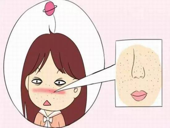 怎么才能告别“草莓鼻”变回小仙女？