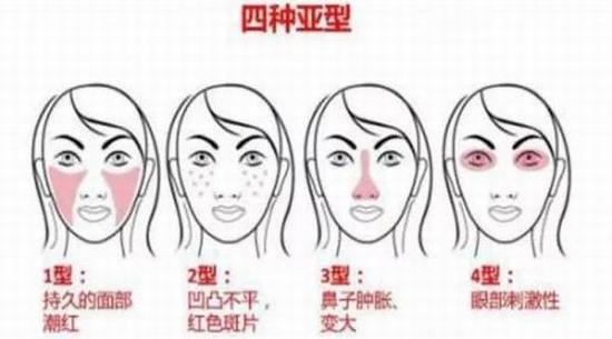 怎么才能告别“草莓鼻”变回小仙女？