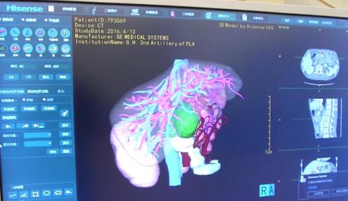 点击进入下一页