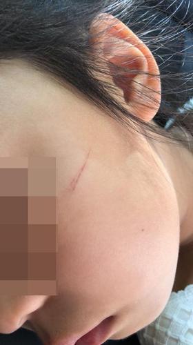 上海幼儿园多名孩子被划伤 疑似保育员所为