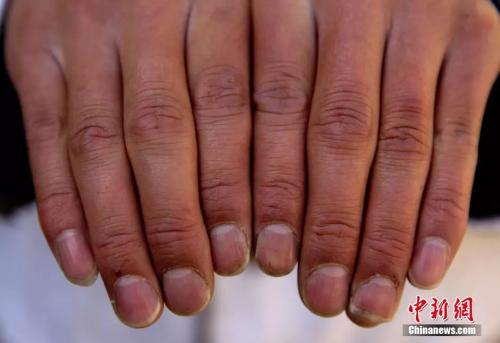 点击进入下一页