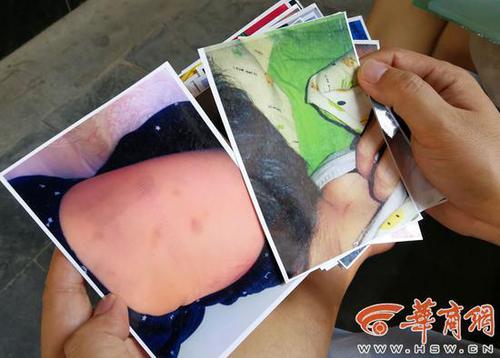 幼儿园内男童遭老师“背摔” 园方:已解聘当事老师