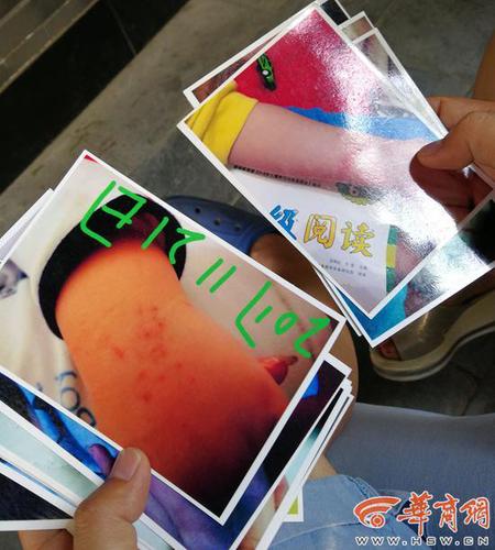 幼儿园内男童遭老师“背摔” 园方:已解聘当事老师