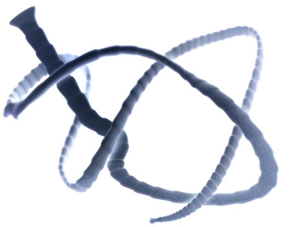 “菊花”里爬出绦虫 究竟是怎么回事？