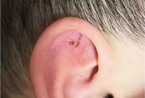 合肥一幼儿看护点被曝虐童 多名老师被带走调查