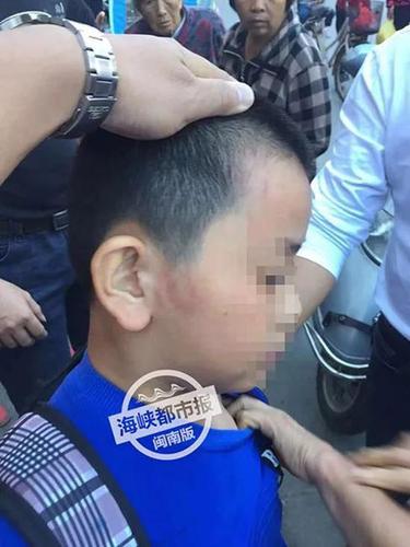 12岁学生被托管班老板打成脑震荡 警方已受案