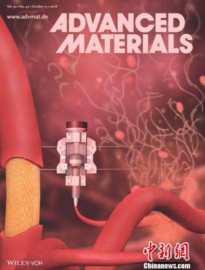 国际生物材料知名杂志封面。医院供图