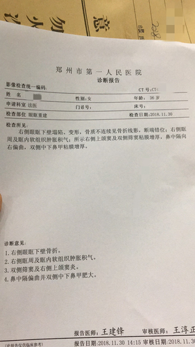 河南政府官员被小22岁妻子举报:多次家暴 婚外生女
