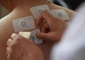 江西儿童被三伏贴灼伤，三伏贴是万能贴吗？