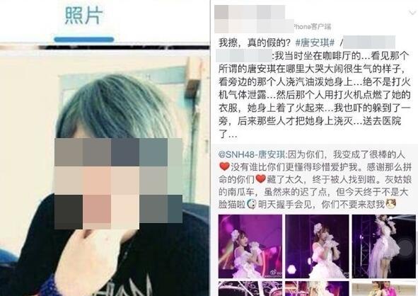 唐安琪被曝遭同行女伴泼汽油 随后被纵火