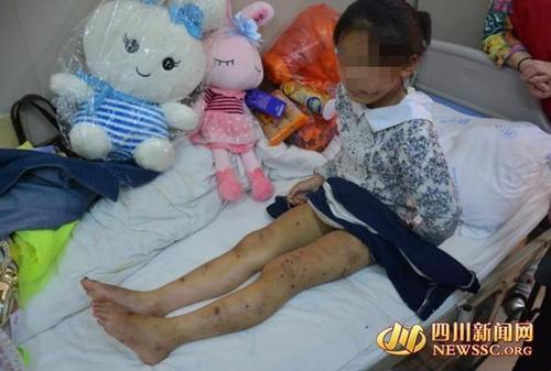 十岁女童遭养母虐待 用钳子夹舌头3