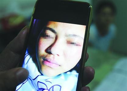 鲍嘉的父母提供的照片显示，鲍嘉的腿部、面部出现淤青红肿。/晨报记者